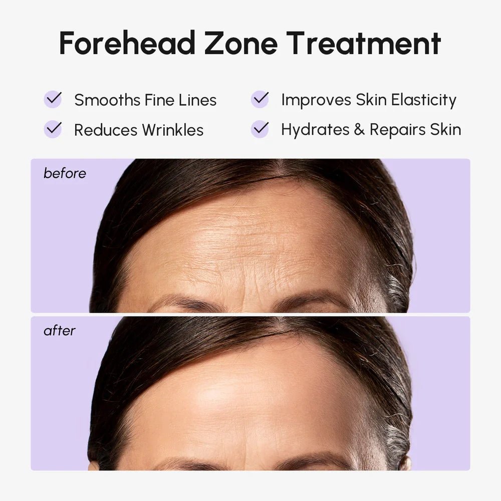 Anti-Wrinkle Forehead Patches - The Coin Has A Say